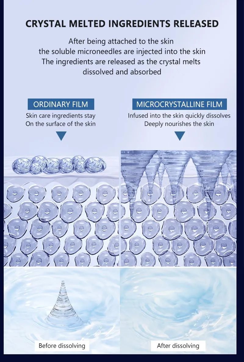 Dissolvable Microneedle Eye Patch